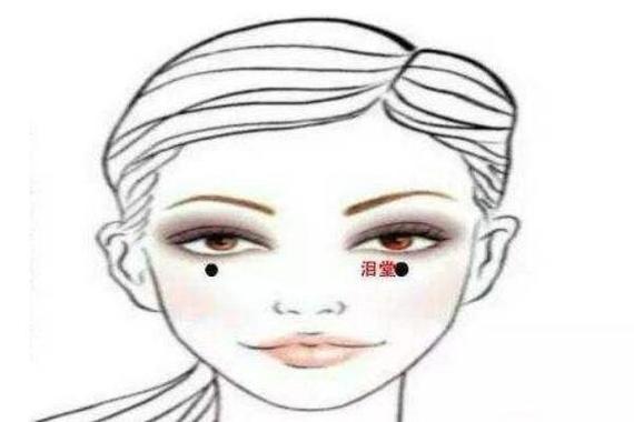 泪堂痣_泪堂痣的正确位置图片
