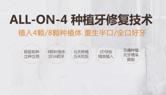种植牙公司起名字怎么起（种植牙名称）
