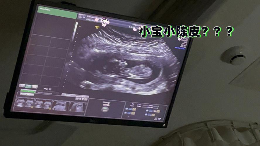 给宝宝肚子起名字（小名肚肚）