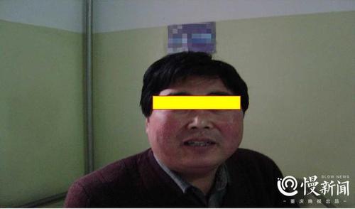满月脸_满月脸水牛背是什么病