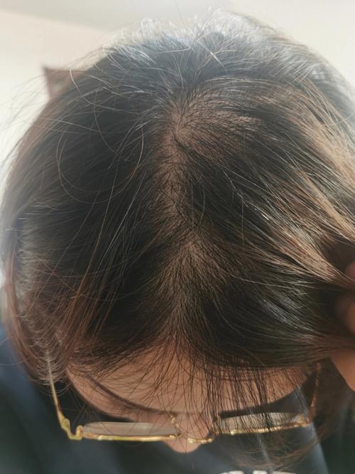 秃的意思_秃的意思是什么